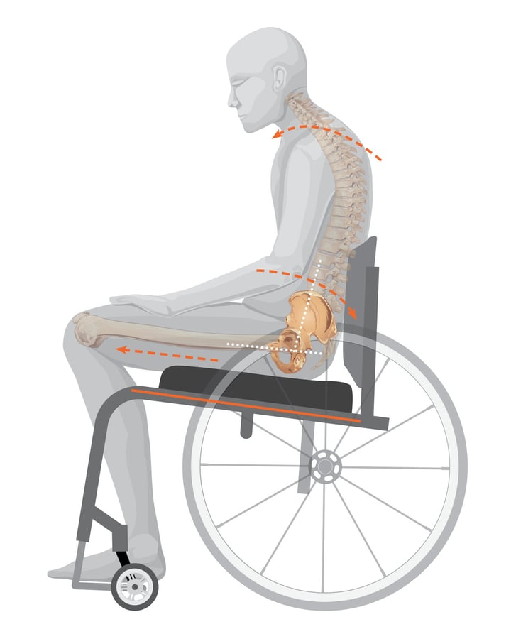 K0005 Configuration Seat Slope and Ergo Seat